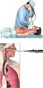 бронхография_процедура